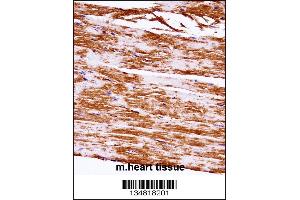 Mouse Map3k5 Antibody immunohistochemistry analysis in formalin fixed and paraffin embedded mouse heart tissue followed by peroxidase conjugation of the secondary antibody and DAB staining. (ASK1 抗体  (C-Term))