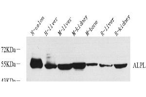 Western Blot analysis of various samples using ALPL Polyclonal Antibody at dilution of 1:1000. (ALPL 抗体)