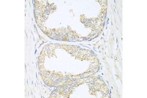 Immunohistochemistry of paraffin-embedded human prostate using SGCB antibody at dilution of 1:100 (40x lens). (SGCB 抗体)