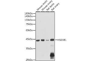 Western blot analysis of extracts of various cell lines, using HSD3B1 antibody (ABIN6131041, ABIN6142016, ABIN6142017 and ABIN6224059) at 1:1000 dilution. (HSD3B1 抗体  (AA 1-290))