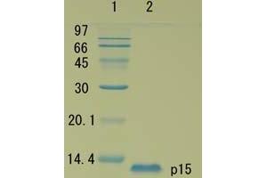 SDS-PAGE (SDS) image for HIV-1 Gag P15 protein (ABIN2452192) (HIV-1 Gag P15 蛋白)