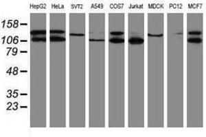 Image no. 2 for anti-SUMO1/sentrin/SMT3 Specific Peptidase 2 (SENP2) (AA 139-523) antibody (ABIN1490928) (SENP2 抗体  (AA 139-523))