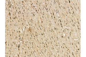 ABIN7094461 and ABIN7098509 at 1/100 staining Rat heart tissue by IHC-P.