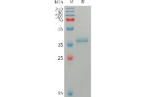 SDS-PAGE (SDS) image for S100 Calcium Binding Protein A4 (S100A4) (AA 2-101) protein (Fc Tag) (ABIN7491357)