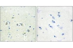 Immunohistochemistry analysis of paraffin-embedded human brain tissue, using GAS6 Antibody.