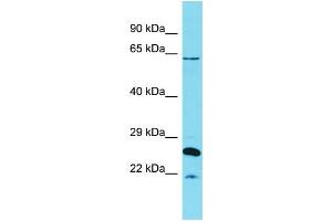 Host:  Rabbit  Target Name:  HCFC1  Sample Type:  Uterus Tumor lysates  Antibody Dilution:  1.