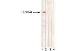 D-dimer, D-monomer and fibrinogen immunodetectionby MAb DD1 in Western blotting. (D-Dimer 抗体)