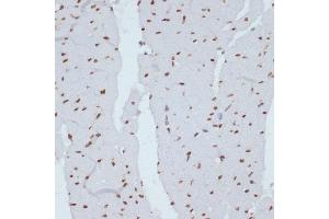 Immunohistochemistry of paraffin-embedded rat heart using Phospho-Chk1-S280 antibody (ABIN3019445, ABIN3019446, ABIN3019447 and ABIN6225372) at dilution of 1:100 (40x lens). (CHEK1 抗体  (pSer280))