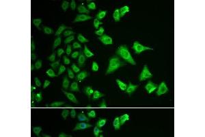 Immunofluorescence analysis of HeLa cells using DHRS2 Polyclonal Antibody (DHRS2 抗体)