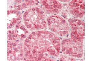 Immunohistochemistry (Paraffin-embedded Sections) (IHC (p)) image for anti-serpin Peptidase Inhibitor, Clade A (Alpha-1 Antiproteinase, Antitrypsin), Member 5 (SERPINA5) (AA 326-375) antibody (ABIN6756644)