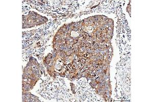 IHC analysis of Integrin alpha 3/ITGA3 using anti-Integrin alpha 3/ITGA3 antibody (ABIN7602696). (ITGA3 抗体  (AA 96-324))