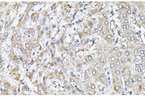 Immunohistochemistry of paraffin-embedded Human liver using Snail Polyclonal Antibody at dilution of 1:100 (40x lens). (SNAIL 抗体)