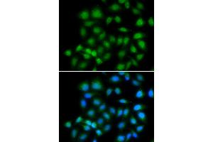 Immunofluorescence analysis of HeLa cells using MXI1 antibody. (MXI1 抗体)