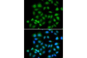 Immunofluorescence analysis of HeLa cells using MXI1 antibody. (MXI1 抗体)