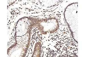 Immunohistochemistry analysis of paraffin-embedded human colon using LEP Polyclonal Antibody at dilution of 1:100. (Leptin 抗体)