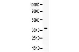 Western blot analysis of RANKL expression in rat brain extract ( Lane 1). (RANKL 抗体  (AA 141-318))