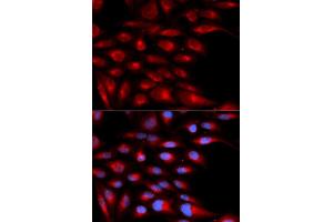 Immunofluorescence (IF) image for anti-alpha-2-Glycoprotein 1, Zinc-Binding (AZGP1) antibody (ABIN1876553) (AZGP1 抗体)