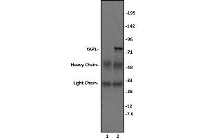 Immunoprecipitation (IP) image for anti-Yes-Associated Protein 1 (YAP1) (C-Term) antibody (ABIN6972915)