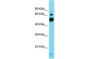 Western Blotting (WB) image for anti-Kelch Repeat and BTB (POZ) Domain Containing 11 (KBTBD11) (C-Term) antibody (ABIN2791602) (KBTBD11 抗体  (C-Term))