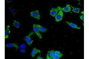 Detection of LEI in Human Hela Cell using Polyclonal Antibody to Leukocyte Elastase Inhibitor (LEI) (SERPINB1 抗体  (AA 184-368))