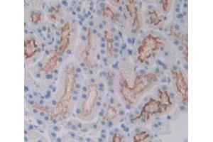 Detection of VEGFR2 in Rat Kidney Tissue using Polyclonal Antibody to Vascular Endothelial Growth Factor Receptor 2 (VEGFR2) (VEGFR2/CD309 抗体  (AA 46-320))