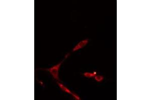 ABIN6274958 staining HepG2 cells by IF/ICC.