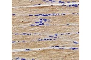 Immunohistochemistry analysis of paraffin-embedded rat muscle using,CTNT (ABIN7076033) at dilution of 1: 400