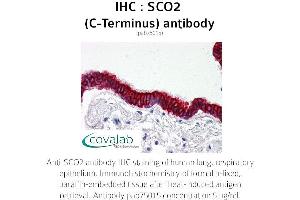 Image no. 2 for anti-SCO2 Cytochrome C Oxidase Assembly Protein (SCO2) antibody (ABIN1739069) (SCO2 抗体)