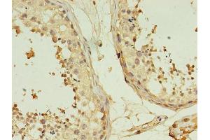 Immunohistochemistry of paraffin-embedded human testis tissue using ABIN7173059 at dilution of 1:100 (TMEM141 抗体  (AA 1-108))