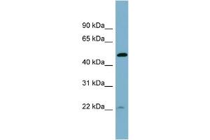 WB Suggested Anti-UCHL5IP  Antibody Titration: 0. (HAUS7 抗体  (Middle Region))