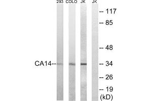 Western Blotting (WB) image for anti-Carbonic Anhydrase XIV (CA14) (Internal Region) antibody (ABIN1851004) (CA14 抗体  (Internal Region))
