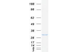 Validation with Western Blot