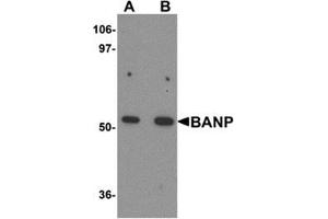 Western blot analysis of BANP in mouse kidney tissue lysate with BANP antibody at (A) 1 and (B) 2 μg/ml. (BANP 抗体  (Center))