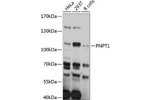 Western blot analysis of extracts of various cell lines, using PNPT1 antibody (ABIN6129746, ABIN6145862, ABIN6145863 and ABIN6215368) at 1:3000 dilution. (PNPT1 抗体  (AA 1-260))