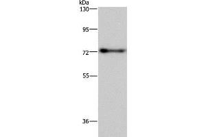 Western Blot analysis of Mouse brain tissue using PATZ1 Polyclonal Antibody at dilution of 1:250 (PATZ1 抗体)