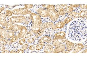 Detection of SOD1 in Bovine Kidney Tissue using Monoclonal Antibody to Superoxide Dismutase 1 (SOD1) (SOD1 抗体  (AA 2-152))