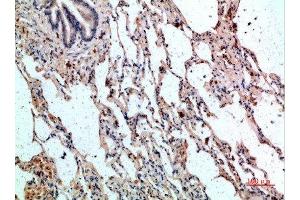 Immunohistochemical analysis of paraffin-embedded human-lung, antibody was diluted at 1:200 (CD236/GYPC 抗体  (AA 11-60))