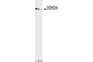 Western Blotting (WB) image for anti-Deleted in Colorectal Carcinoma (DCC) antibody (ABIN967443) (DCC 抗体)