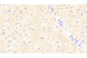Immunohistochemistry (IHC) image for anti-Signal Transducer and Activator of Transcription 3 (Acute-Phase Response Factor) (STAT3) (AA 346-552) antibody (ABIN7444052)