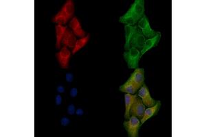 ABIN6257222 and ABIN6276028 staining Hela cells by IF/ICC. (GPR17 抗体  (C-Term))