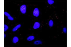 Proximity Ligation Analysis of protein-protein interactions between MAPK3 and BRAF. (BRAF 抗体  (AA 346-445))