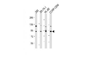 All lanes : Anti-P9 Antibody at 1:500-1:2000 dilution Lane 1: 293 whole cell lysate Lane 2: ZR-75-1 whole cell lysate Lane 3: HL-60 whole cell lysate Lane 4: CCRF-CEM whole cell lysate Lysates/proteins at 20 μg per lane. (MMP 9 抗体)