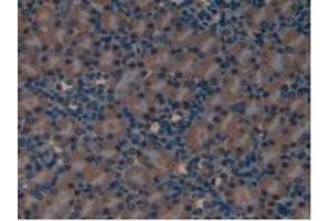 IHC-P analysis of Mouse Kidney Tissue, with DAB staining. (LIFR 抗体  (AA 381-485))