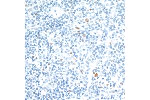 Immunohistochemistry (IHC) image for anti-V-Maf Musculoaponeurotic Fibrosarcoma Oncogene Homolog (Avian) (MAF) (AA 125-175) antibody (ABIN7455089) (Recombinant MAF 抗体  (AA 125-175))