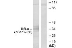 Western blot analysis of extracts from COS7 cells, using IkappaB-alpha (Phospho-Ser32/Ser36) Antibody. (NFKBIA 抗体  (pSer32))