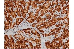 ABIN6267389 at 1/200 staining Human pancreas tissue sections by IHC-P. (ATF2 抗体  (pThr51, pThr69))