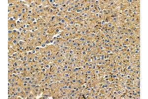 ABIN7095553 and ABIN7099610 at 1/100 staining mouse liver tissue by IHC-P. (IREB2 抗体)