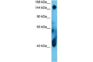 Host:  Rabbit  Target Name:  COIA1  Sample Type:  MCF7 Whole Cell  Antibody Dilution:  1. (COL18A1 抗体  (Middle Region))