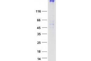 TM9SF1 Protein (Transcript Variant 1) (Myc-DYKDDDDK Tag)