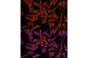 Immunofluorescence analysis of L929 cells using Sec23B antibody (ABIN7270169) at dilution of 1:100. (Sec23 Homolog B 抗体  (AA 150-250))